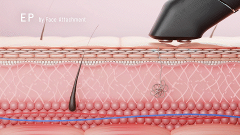 エレクトロポレーション