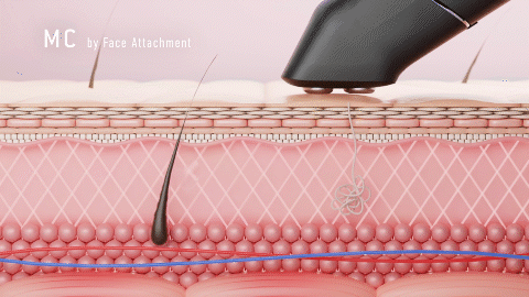 マイクロカレント