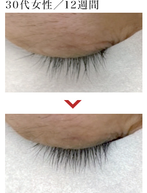 30代女性／12週間