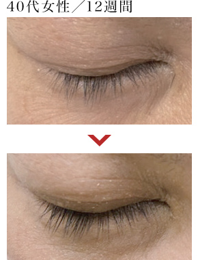 40代女性／12週間 