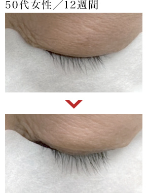 50代女性／12週間